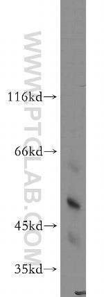 HARS2 Antibody in Western Blot (WB)