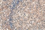 ribosomal protein L4 Antibody in Immunohistochemistry (Paraffin) (IHC (P))