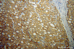 Rab18 Antibody in Immunohistochemistry (Paraffin) (IHC (P))