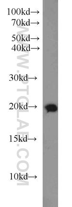 Rab18 Antibody in Western Blot (WB)