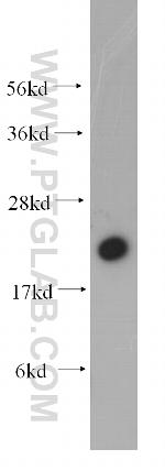 Rab18 Antibody in Western Blot (WB)