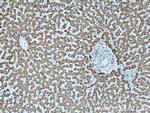 ECHS1 Antibody in Immunohistochemistry (Paraffin) (IHC (P))