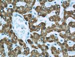 ECHS1 Antibody in Immunohistochemistry (Paraffin) (IHC (P))