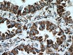 LPXN Antibody in Immunohistochemistry (Paraffin) (IHC (P))