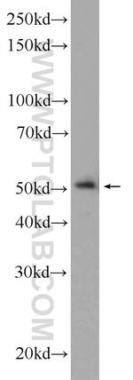 LPXN Antibody in Western Blot (WB)