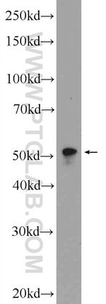 LPXN Antibody in Western Blot (WB)