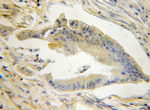 STMN3 Antibody in Immunohistochemistry (Paraffin) (IHC (P))