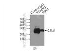 STMN3 Antibody in Immunoprecipitation (IP)