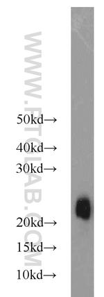 STMN3 Antibody in Western Blot (WB)