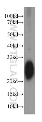 STMN3 Antibody in Western Blot (WB)