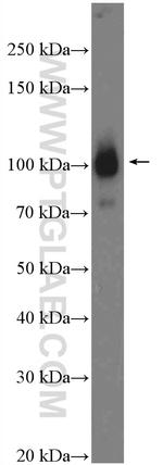 alpha Actinin Antibody in Western Blot (WB)