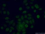 EYA2 Antibody in Immunocytochemistry (ICC/IF)