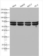 HEXA Antibody in Western Blot (WB)