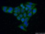 HEXA Antibody in Immunocytochemistry (ICC/IF)