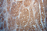 HEXA Antibody in Immunohistochemistry (Paraffin) (IHC (P))