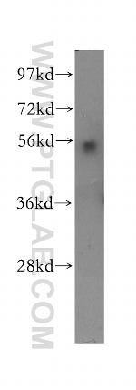 HEXA Antibody in Western Blot (WB)