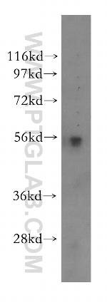 HEXA Antibody in Western Blot (WB)