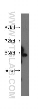 HEXA Antibody in Western Blot (WB)