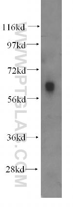HEXA Antibody in Western Blot (WB)