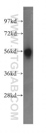HEXA Antibody in Western Blot (WB)