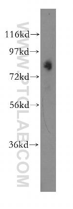 OSBPL11 Antibody in Western Blot (WB)