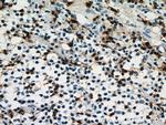 CD7 Antibody in Immunohistochemistry (Paraffin) (IHC (P))