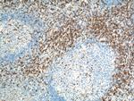 CD7 Antibody in Immunohistochemistry (Paraffin) (IHC (P))
