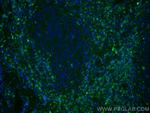 CD7 Antibody in Immunohistochemistry (PFA fixed) (IHC (PFA))
