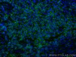 CD7 Antibody in Immunohistochemistry (PFA fixed) (IHC (PFA))
