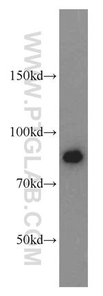 ATRIP Antibody in Western Blot (WB)