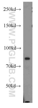 ATRIP Antibody in Western Blot (WB)