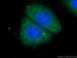 RAB35 Antibody in Immunocytochemistry (ICC/IF)