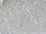 RAB35 Antibody in Immunohistochemistry (Paraffin) (IHC (P))