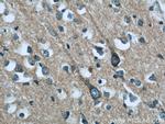 RAB35 Antibody in Immunohistochemistry (Paraffin) (IHC (P))