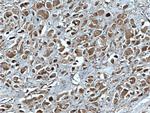 RAB35 Antibody in Immunohistochemistry (Paraffin) (IHC (P))