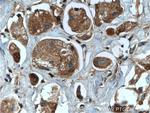 RAB35 Antibody in Immunohistochemistry (Paraffin) (IHC (P))