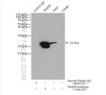 RAB35 Antibody in Immunoprecipitation (IP)