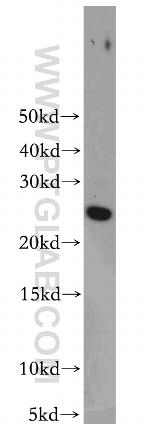 RAB35 Antibody in Western Blot (WB)