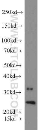 RAB35 Antibody in Western Blot (WB)