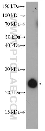 RAB35 Antibody in Western Blot (WB)