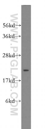 RAB35 Antibody in Western Blot (WB)