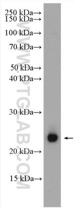 RAB35 Antibody in Western Blot (WB)