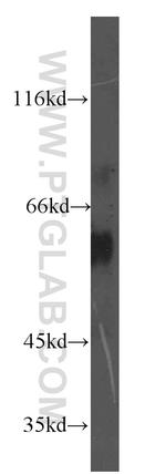 EIF2B4 Antibody in Western Blot (WB)
