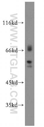 EIF2B4 Antibody in Western Blot (WB)
