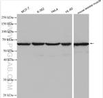 EIF2B4 Antibody in Western Blot (WB)