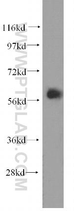 EIF2B4 Antibody in Western Blot (WB)