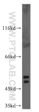 PTP1B Antibody in Western Blot (WB)