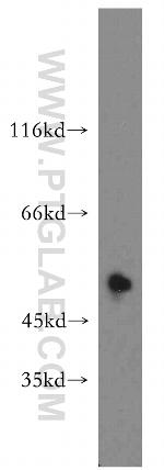 PTP1B Antibody in Western Blot (WB)