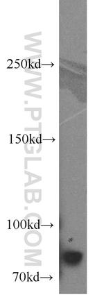 CBFA2T2 Antibody in Western Blot (WB)
