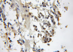 CBFA2T2 Antibody in Immunohistochemistry (Paraffin) (IHC (P))